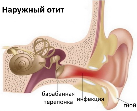 Мокнуть вуха всередині у дорослого: лікування чому мокро