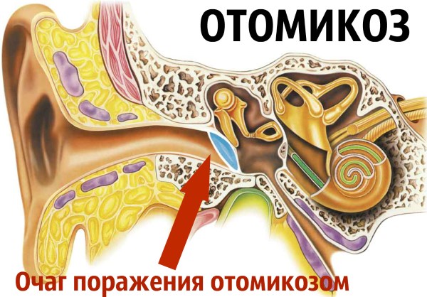 Мокнуть вуха всередині у дорослого: лікування чому мокро