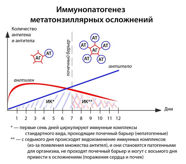 Можливі причини головного болю при ангіні методи діагностики та лікування Можливі причини головного болю при ангіні методи діагностики та лікування
