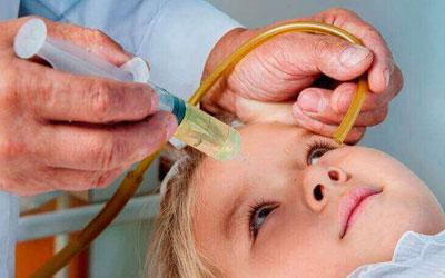 Чи можна промивати ніс морською сіллю при гаймориті