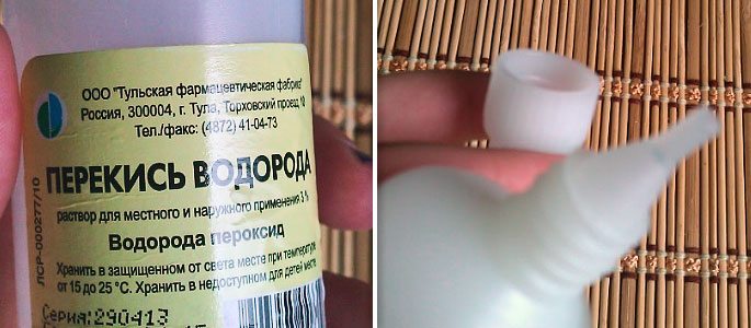 Чи можна заливати перекис водню у вухо при закладеності і болю