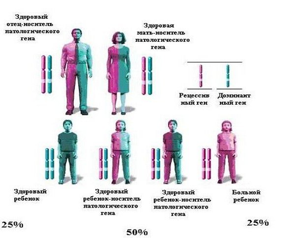 Муковісцидоз у дорослих – симптоми, ознаки, лікування