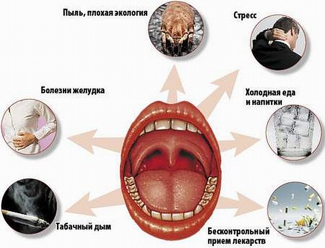 Чим лікувати хронічний тонзиліт у дорослих