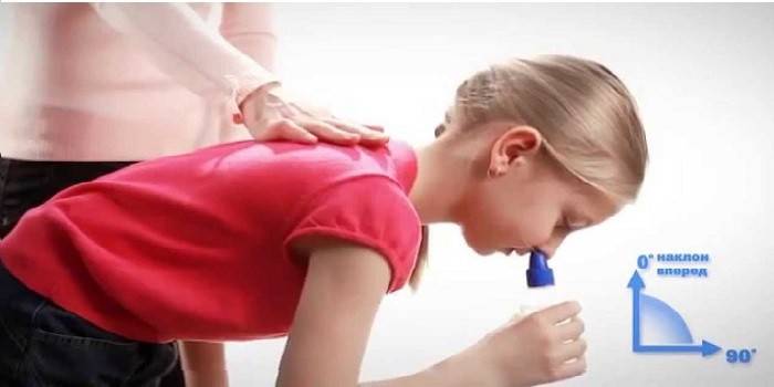 Чим лікувати затяжний нежить у дорослого Чим лікувати затяжний нежить у дорослого