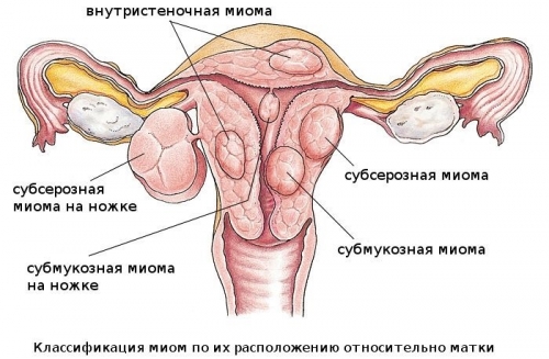 На який день циклу робити УЗД при міомі матки