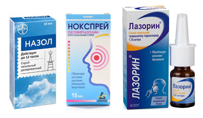 Набряк гайморових пазух без гною