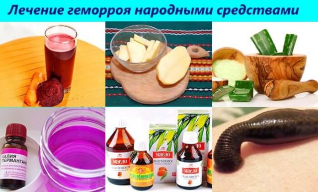 Народні засоби для лікування геморою у жінок