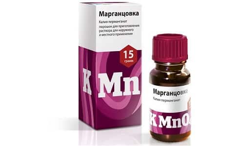Народні засоби лікування геморою у чоловіків в домашніх умовах