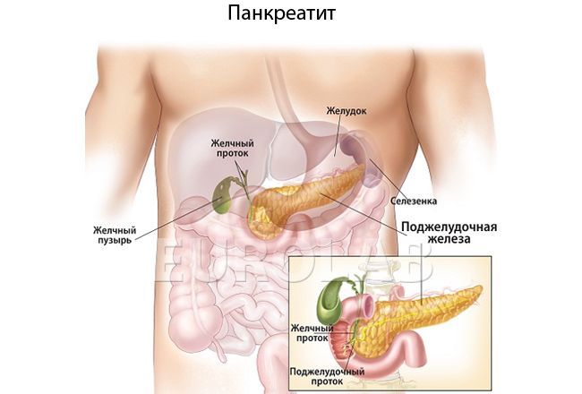 Народні засоби лікування підшлункової залози у жінок