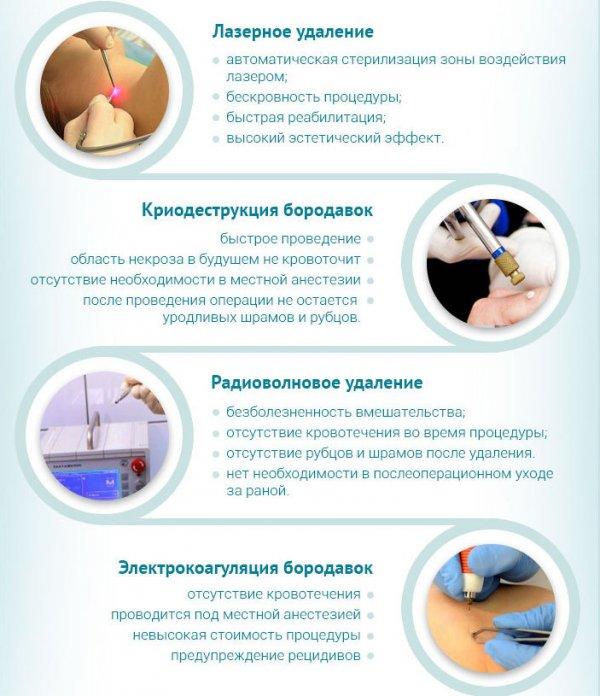 Народні засоби від бородавки на пальцях рук