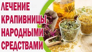 Народні засоби від корости у людини