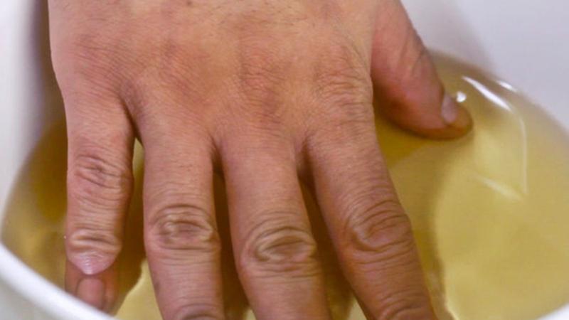 Народні засоби від корости у людини