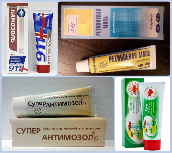 Народні засоби від натоптишів
