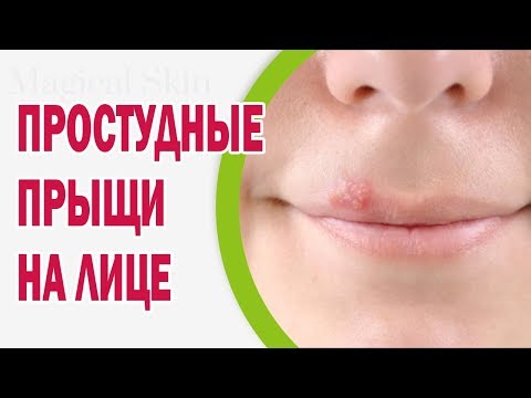 Народні засоби від нежитю і закладеності носа для дітей