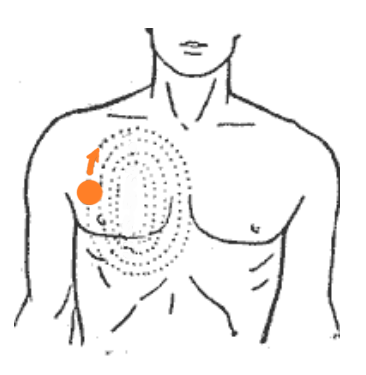 Народні засоби від підвищеного тиску: найбільш ефективні методи зниження в домашніх умовах