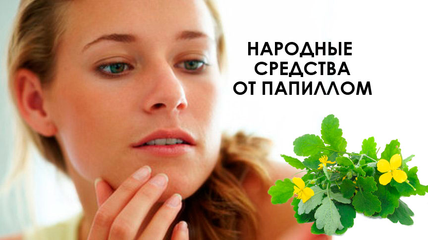 Народні засоби від папілом. Лікування папілом народними засобами. Як позбутися від вірусу