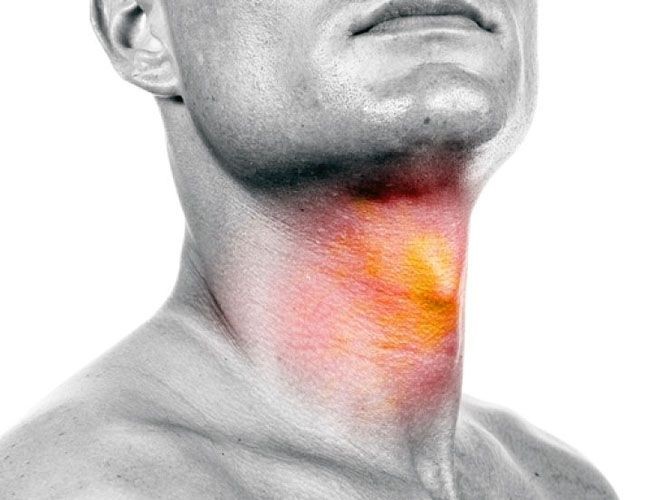 Народні засоби від першіння в горлі Народні засоби від першіння в горлі