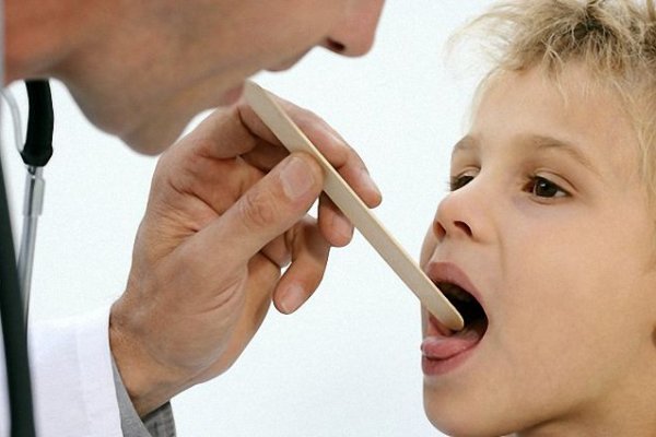 Народні засоби від першіння в горлі Народні засоби від першіння в горлі