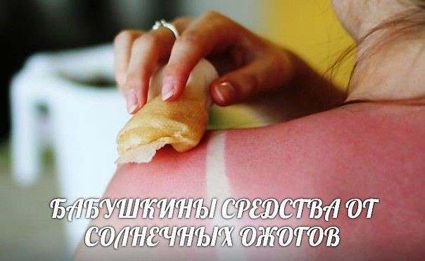 Народні засоби від сонячних опіків
