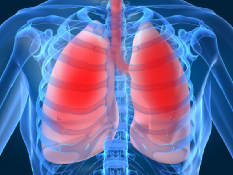 Народні засоби від туберкульозу легенів у дорослих Народні засоби від туберкульозу легенів у дорослих