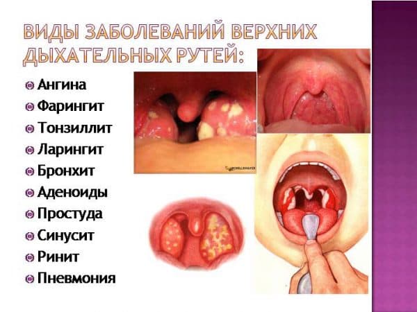 Народні засоби від застуди і кашлю Народні засоби від застуди і кашлю