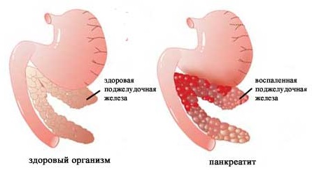 Насіння кропу в народній медицині
