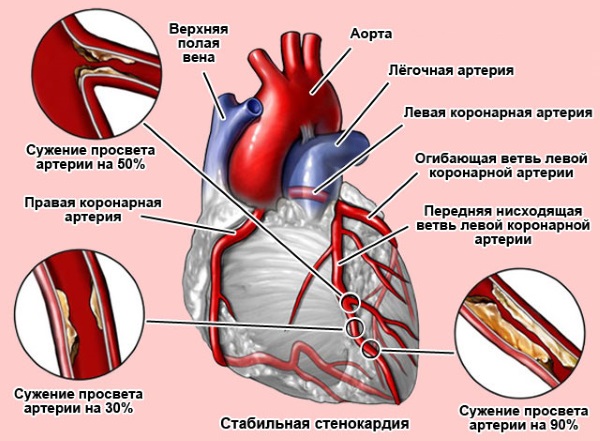 Насіння кропу в народній медицині