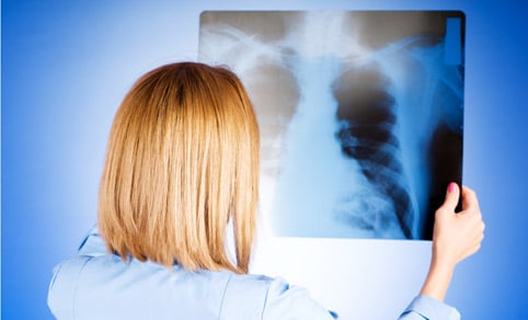 Наслідки пневмонії у дорослих Наслідки пневмонії у дорослих