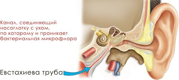 Наслідки та ускладнення, або що буде, якщо не лікувати гайморит? Наслідки запущеного гаймориту у дорослих і дітей