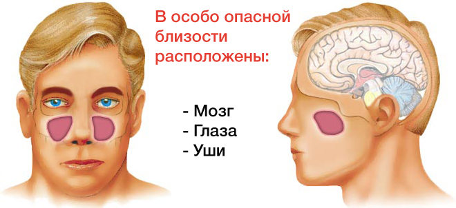 Наслідки ускладнення гаймориту