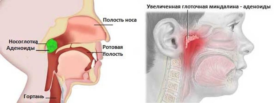 Настоянка воскової молі, застосування лікуванні