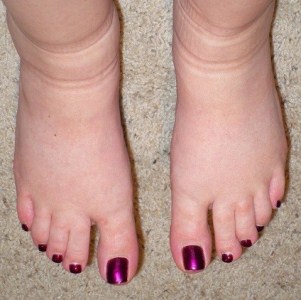 Натоптиші на підошві зі стрижнем лікування народними засобами