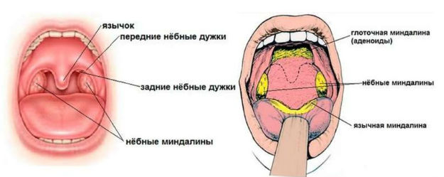 Навіщо потрібні гланди людині можливі захворювання лікування і процедура видалення