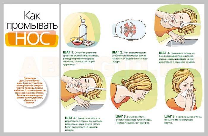 Навіщо промивати ніс солоною водою при нежиті. Промивання носа солоною водою: навіщо, коли і як проводити процедуру. Як промити ніс дитині правильно сольовим розчином