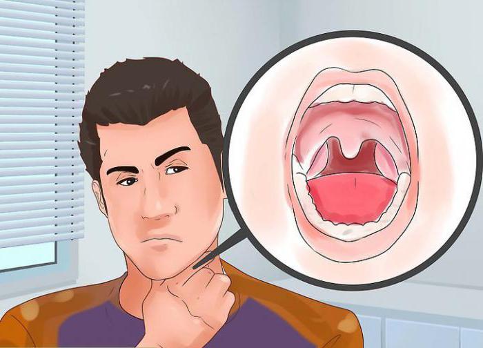 Неприємний запах з горла основні причини симптому