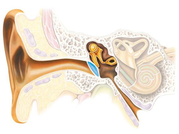 Нейросенсорна приглухуватість (сенсоневральна) – симптоми і лікування. Лікується чи ні нейросенсорна втрата слуху?
