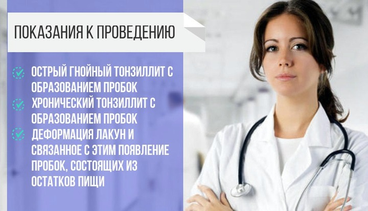 Обробка горла при ангіні – Все про ангіні