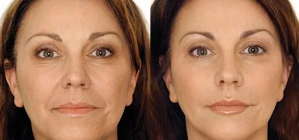 Очищаючі маски для обличчя з желатином і медом