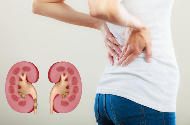 Очищення нирок у домашніх умовах — 7 простих способів Очищення нирок у домашніх умовах — 7 простих способів