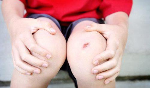 Одне й те ж Хлоргексидин і перекис водню і що краще