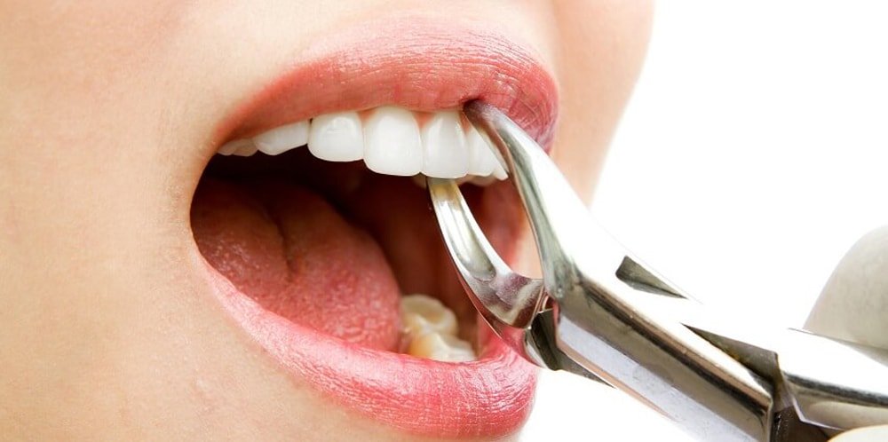 Одонтогенний гайморит лікування народними засобами Одонтогенний гайморит лікування народними засобами