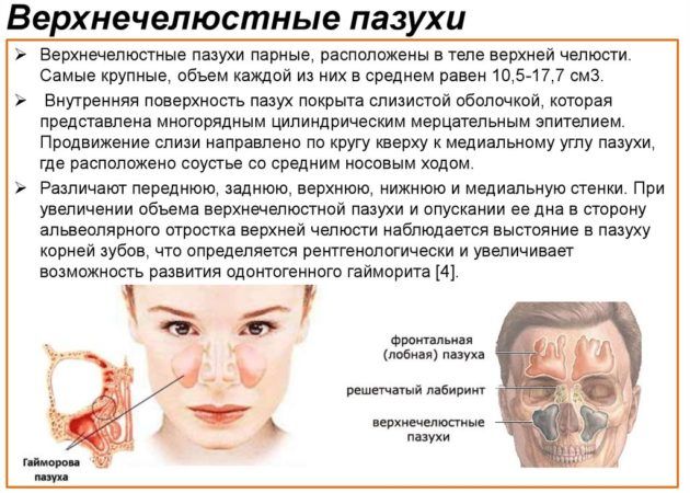 Одонтогенний гайморит – опис, симптоми і лікування