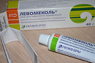 Околоушный свищ: причини, симптоми та особливості лікування Околоушный свищ: причини, симптоми та особливості лікування