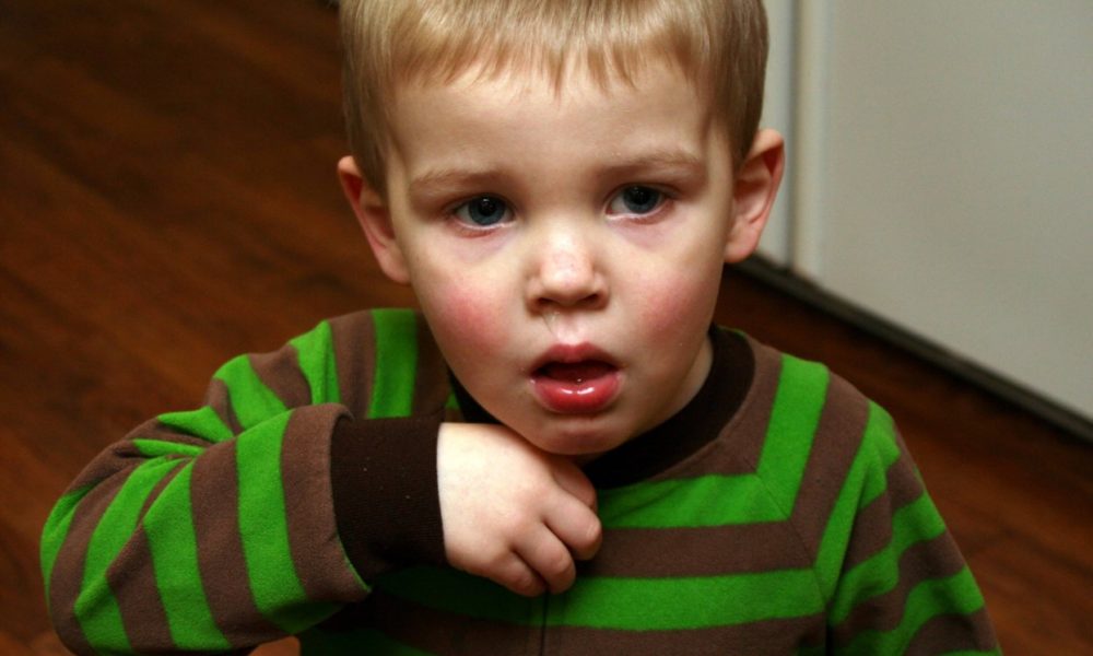 Основні причини сухого кашлю у ребнка і його лікування