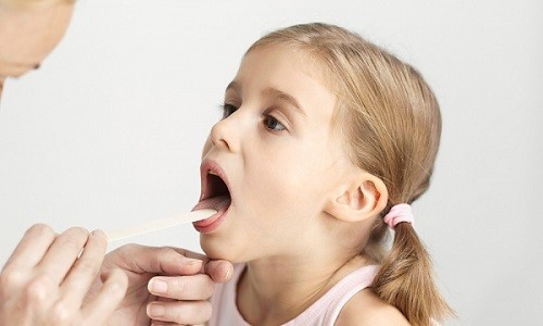 Особливості лікування аденоїдів народними засобами у дітей Особливості лікування аденоїдів народними засобами у дітей