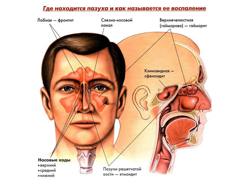 Особливості лікування гаймориту у дітей