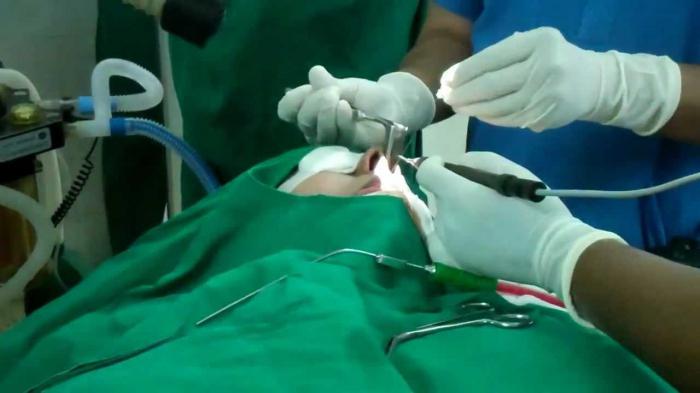 Особливості лікування хронічного вазомоторного риніту
