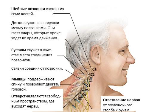 Остеохондроз шийного відділу хребта лікування народними засобами