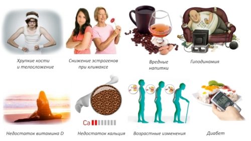 Остеопенія лікування препарати. Лікування остеопенії народними засобами
