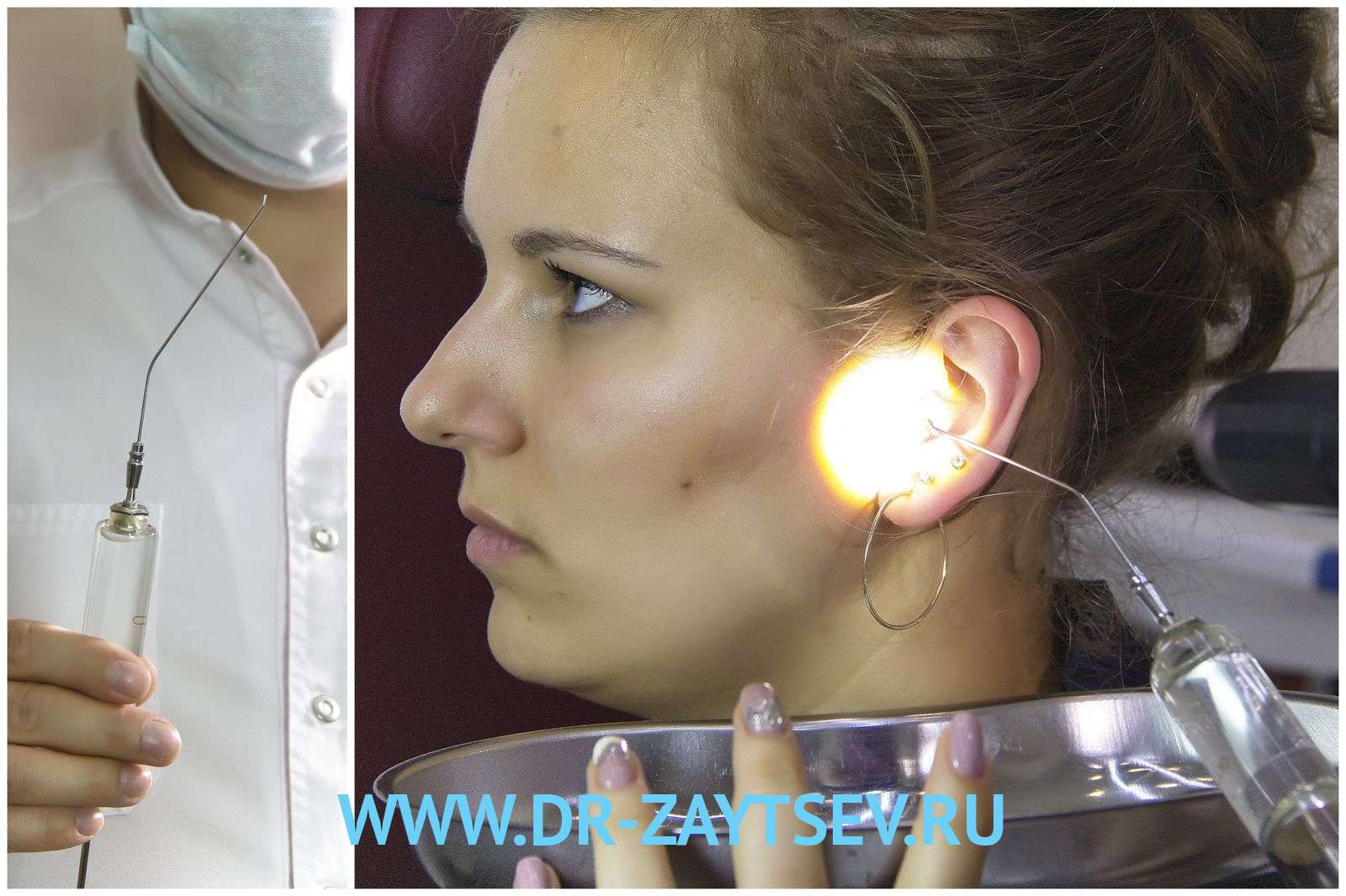 Отит – причини, симптоми, що робити, як лікувати отит? Наслідки та профілактика Отит – причини, симптоми, що робити, як лікувати отит? Наслідки та профілактика